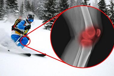 ¿Son los esquís anchos malos para tus rodillas?