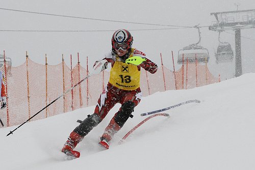 Fotografía de esquiador con la mano izquierda amputada en un descenso.