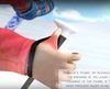 STA: El invento español para evitar la lesión del 'pulgar del esquiador'