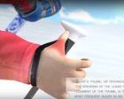 STA: El invento español para evitar la lesión del 'pulgar del esquiador'